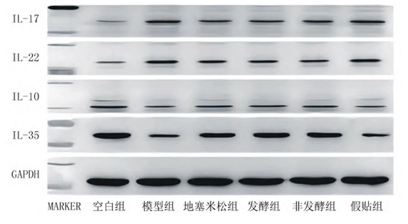 空白組和支氣管哮喘各組大鼠肺組織中IL－17、IL－22、IL－10、IL－35蛋白表達(dá)電泳圖